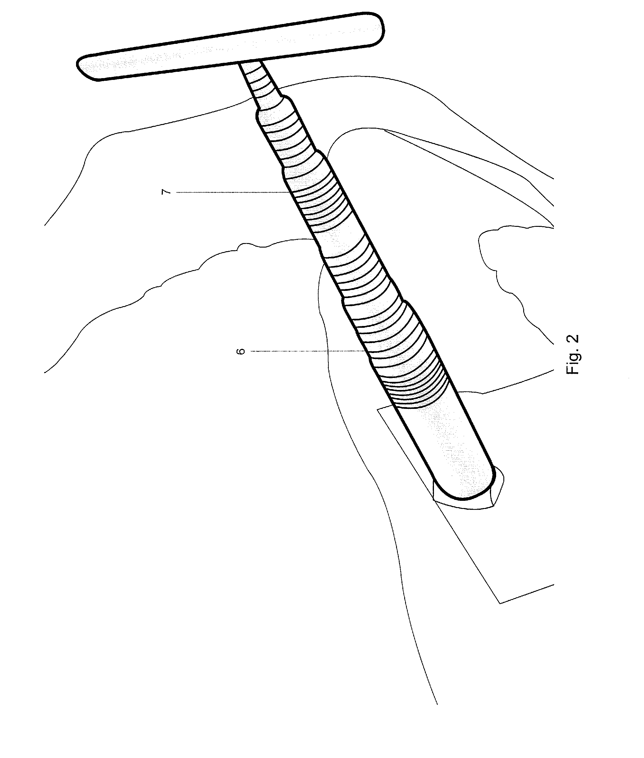 Minimally Invasive Instruments and Methods for the Micro Endoscopic Application of Spine Stabilizers in the Interspinous Space