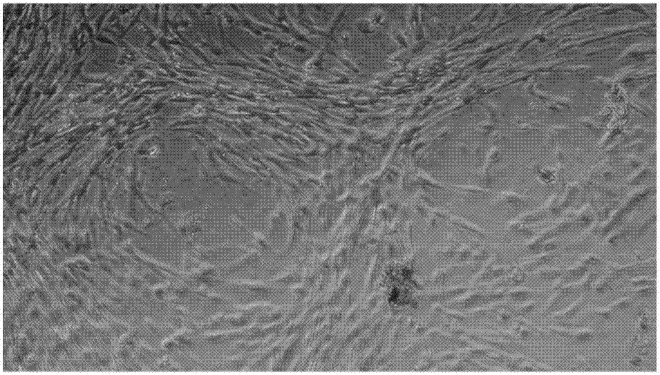 Human umbilical cord mesenchymal stem cell culture method