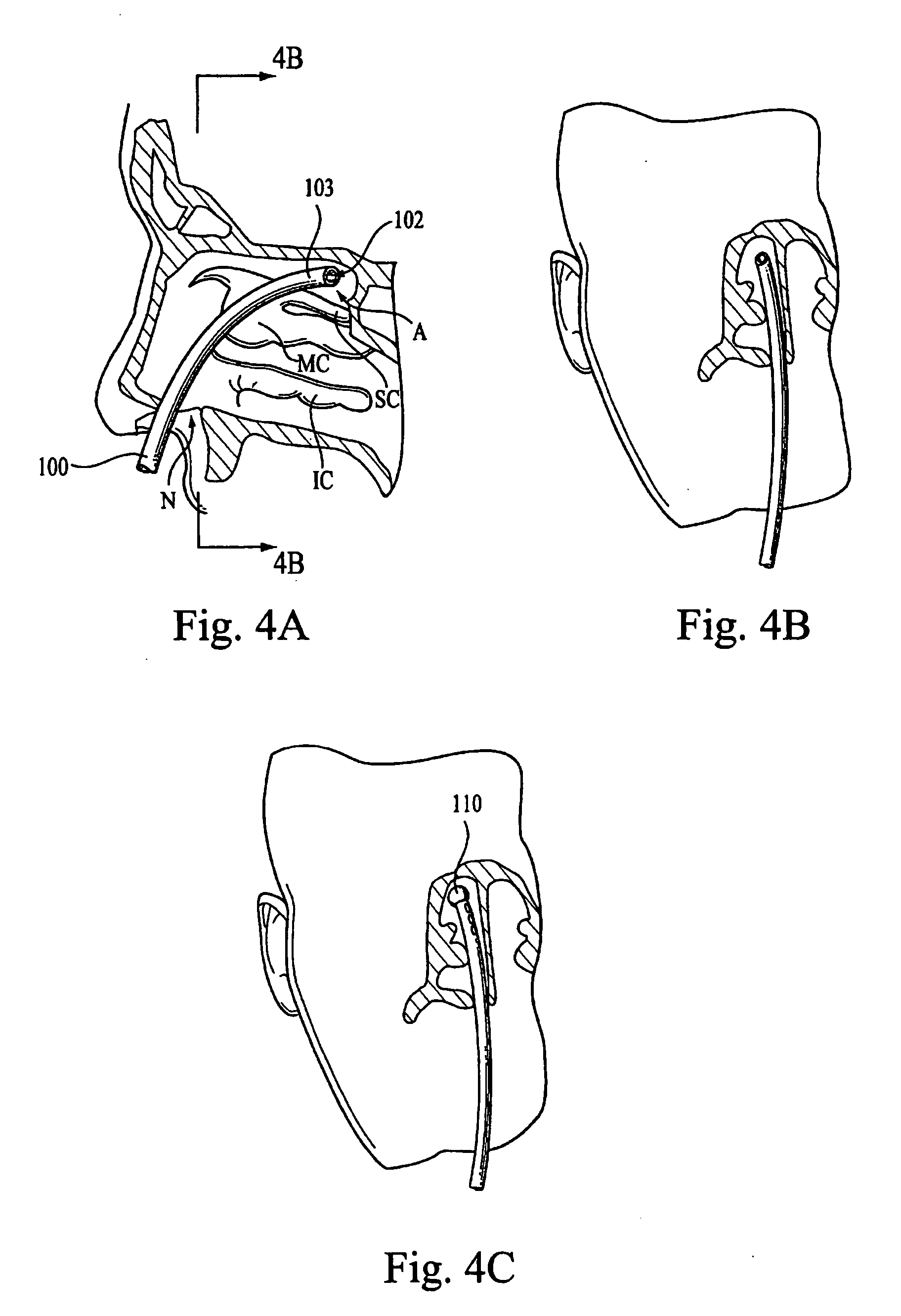 Directed intranasal administration of pharmaceutical agents