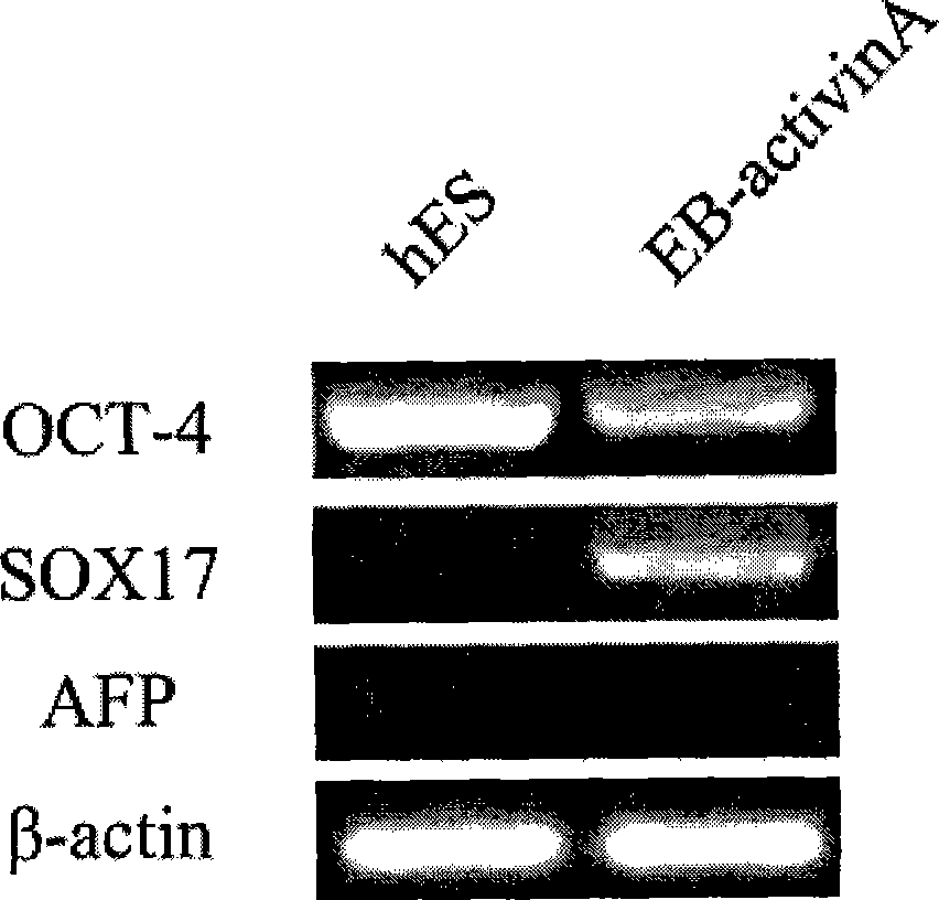 Method for inducing human embryo stem cell for directional differentiation into hepatocyte and special culture medium