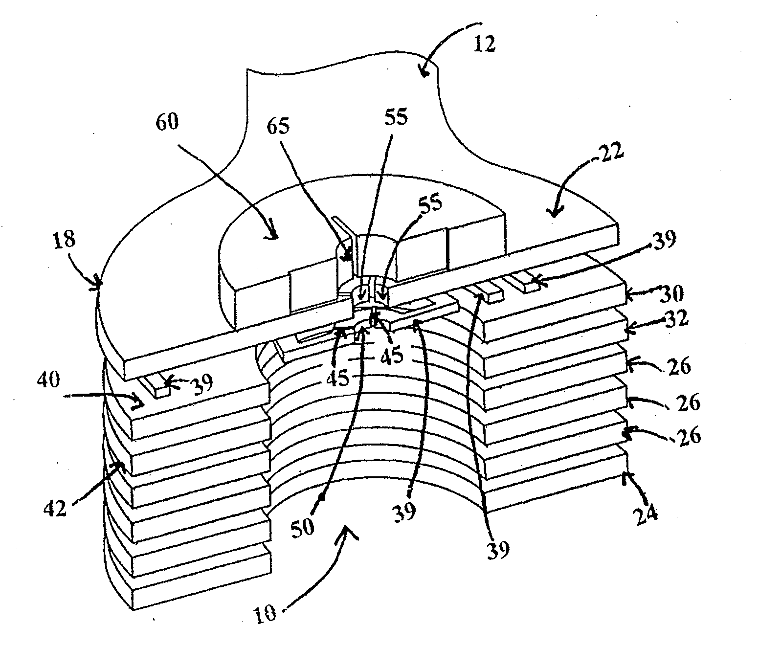 Radiolucent Electrode Assembly