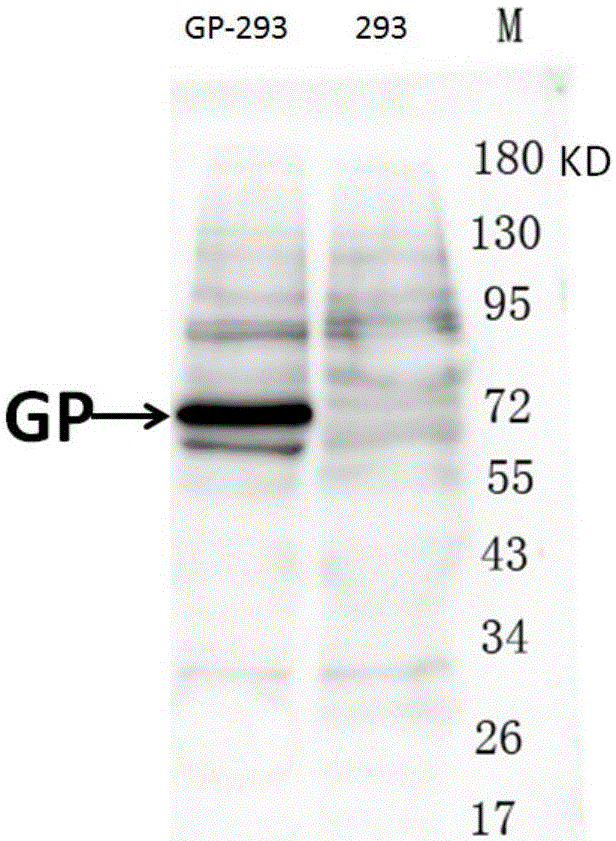 Hybridoma cell strain ZJED0-02, anti-Ebola virus GP (glycoprotein) monoclonal antibody and their preparation and application