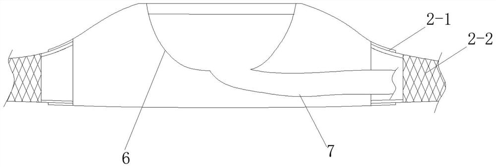 X-shaped hemodialysis port