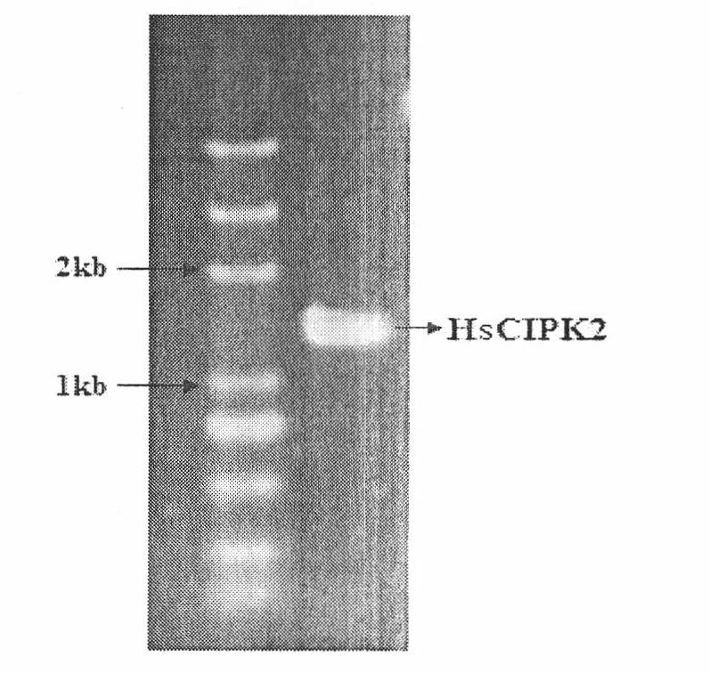 HsCIPK2 gene of Hordeum spontoneum C. Koch on Tibetan Plateau