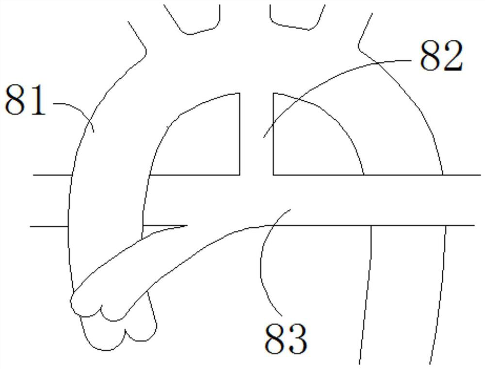 Brackets and Bracket Systems