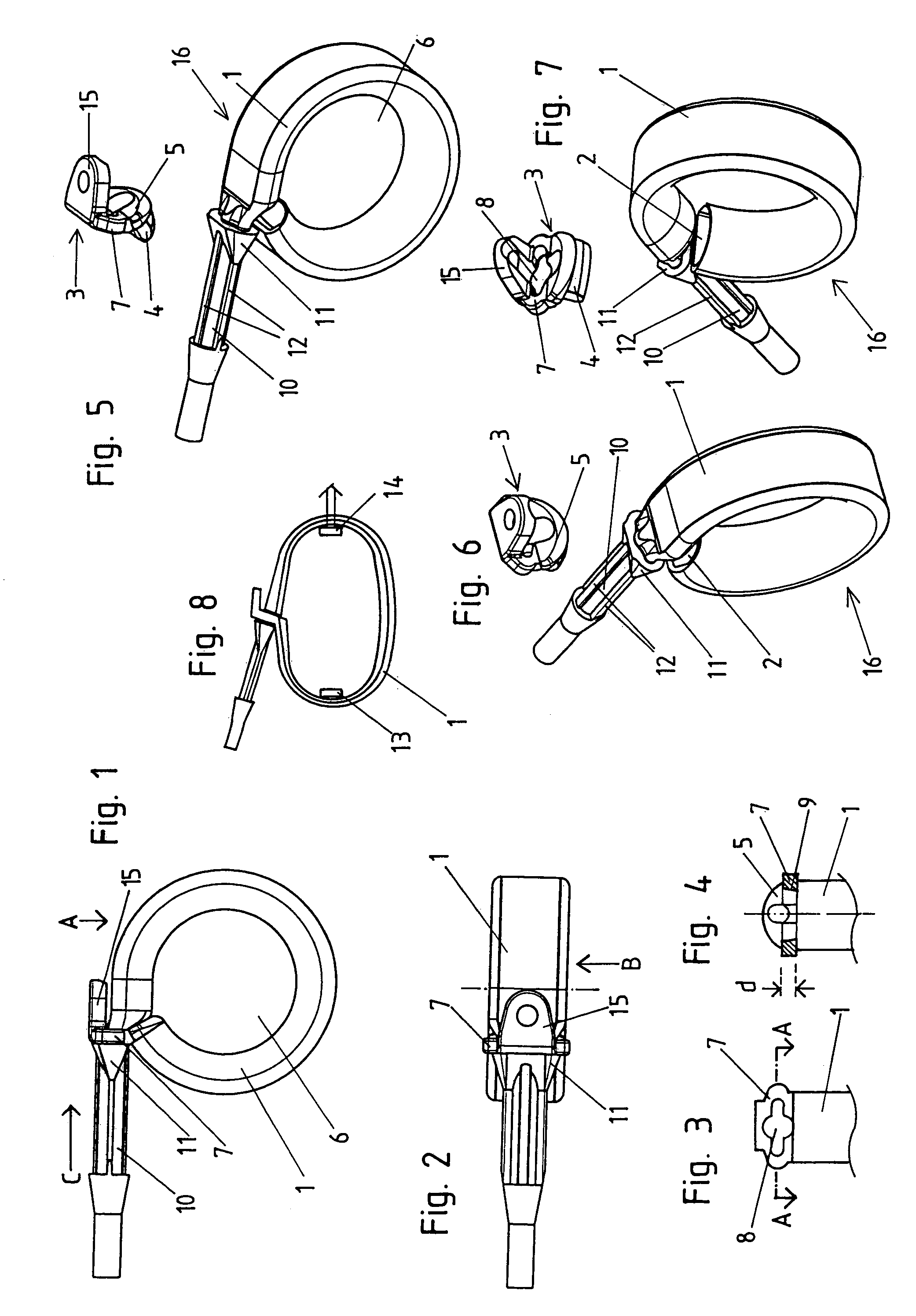 Device for generating an artificial constriction in the gastrointestinal tract