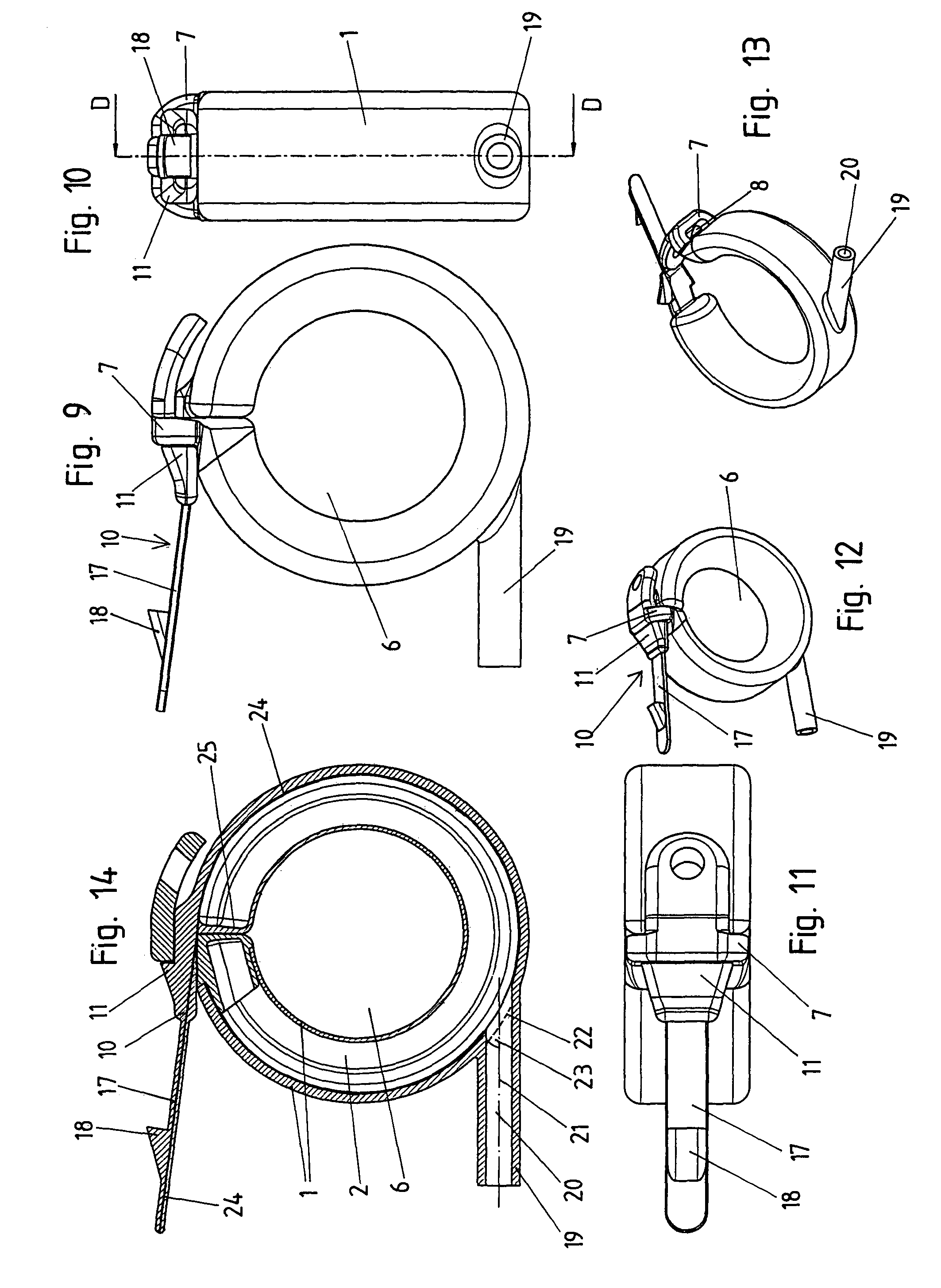Device for generating an artificial constriction in the gastrointestinal tract