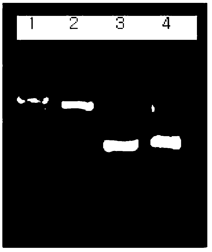 Method for detecting mycobacterium tuberculosis and nontuberculous mycobacteria using duplex polymerase chain reaction