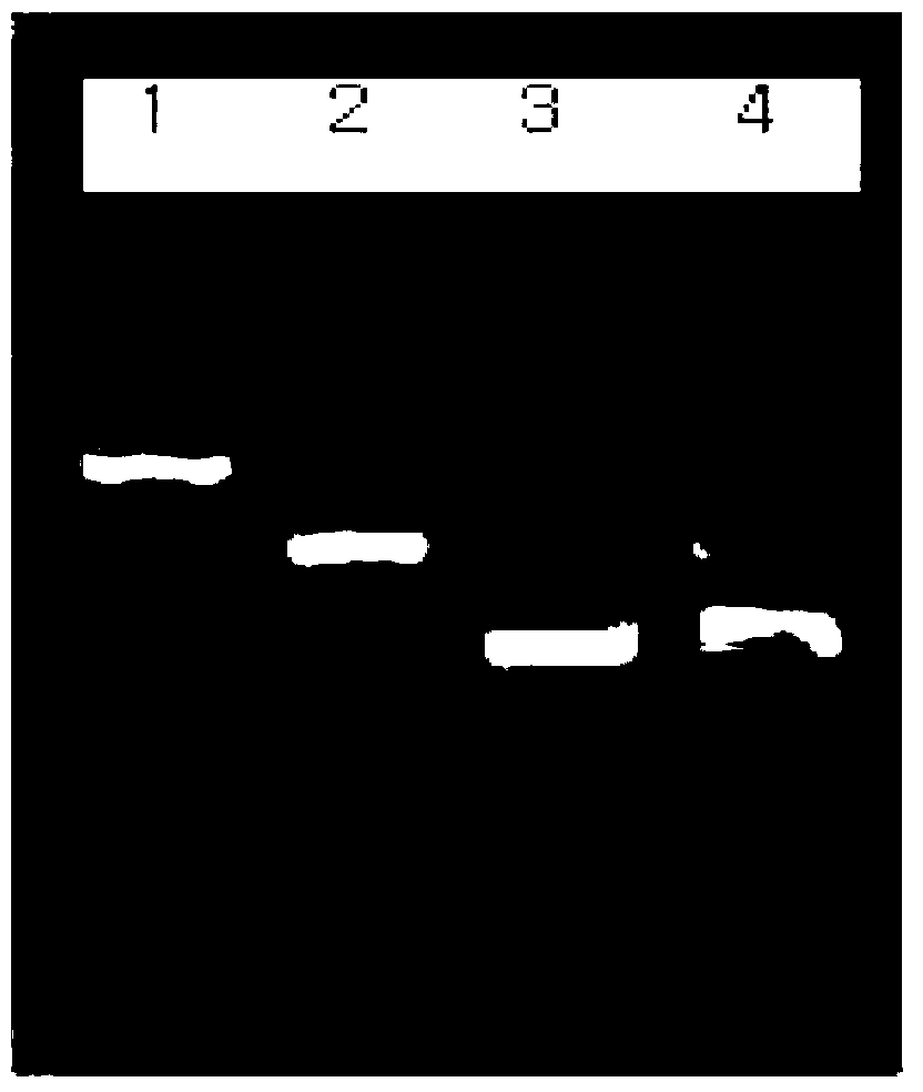 Method for detecting mycobacterium tuberculosis and nontuberculous mycobacteria using duplex polymerase chain reaction