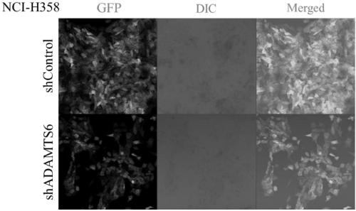 ADAMTS6 gene and shRNA sequences thereof and application in antihuman lung cancer