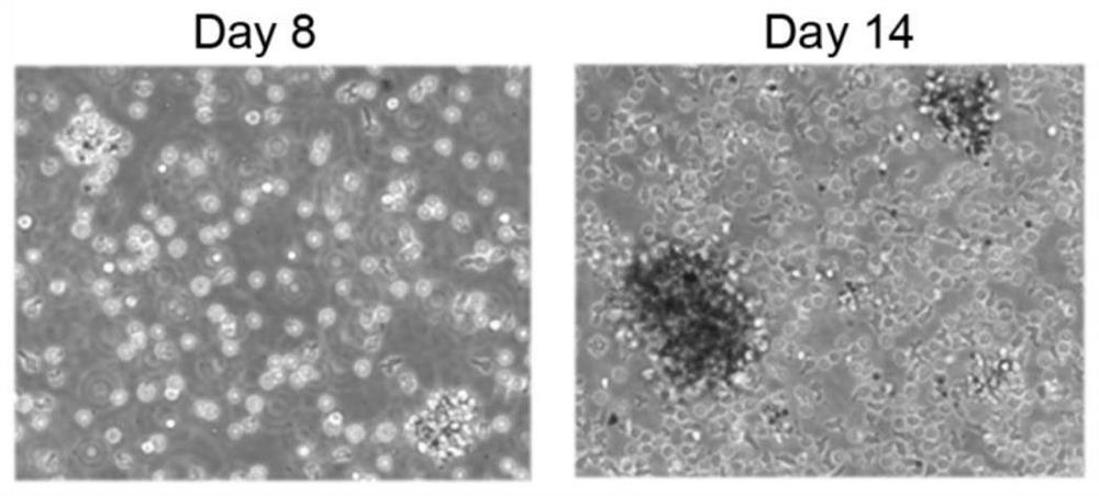 A method and application of umbilical cord blood Treg cell expansion in vitro based on trophoblast cells