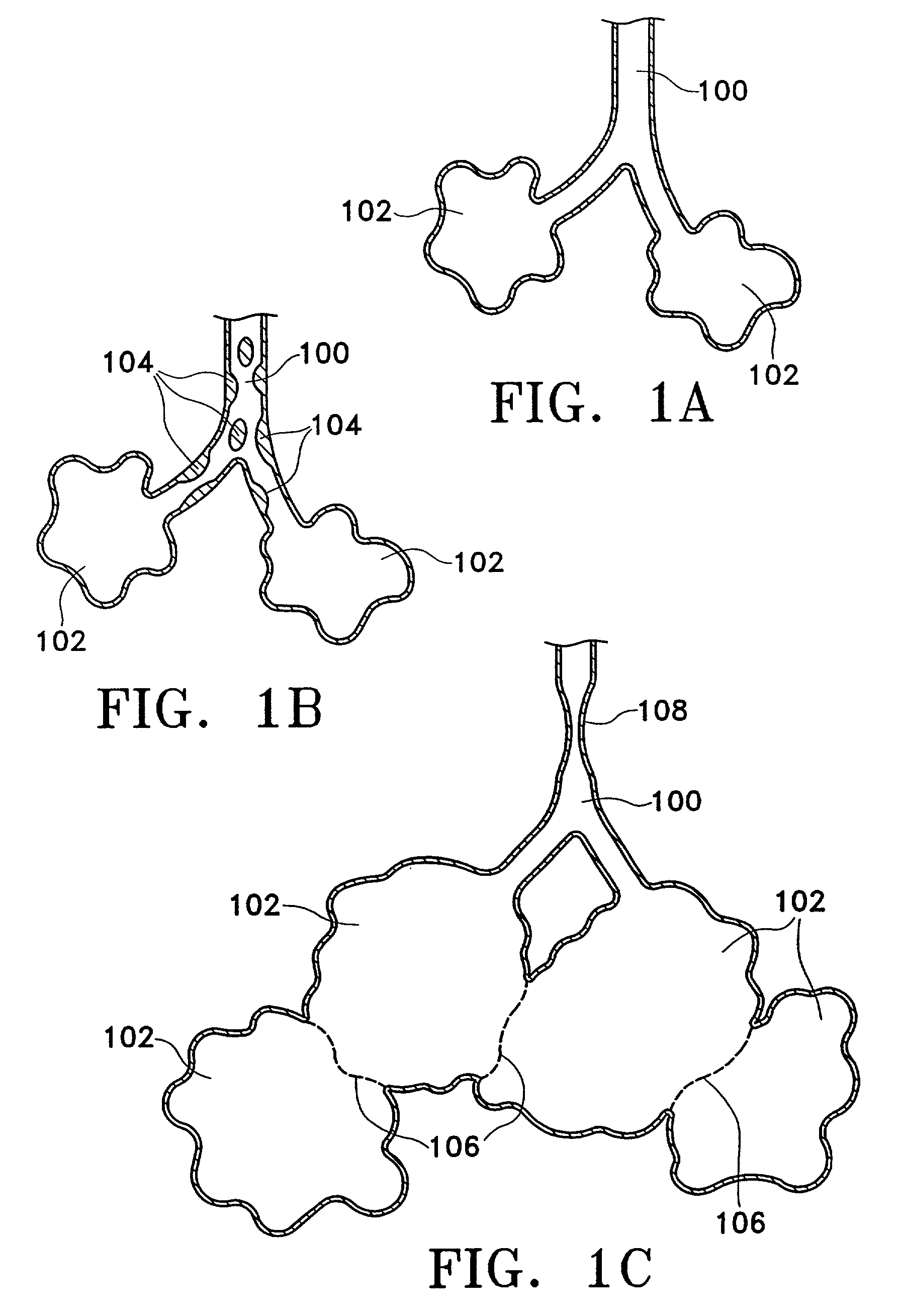 Devices and methods for maintaining collateral channels in tissue