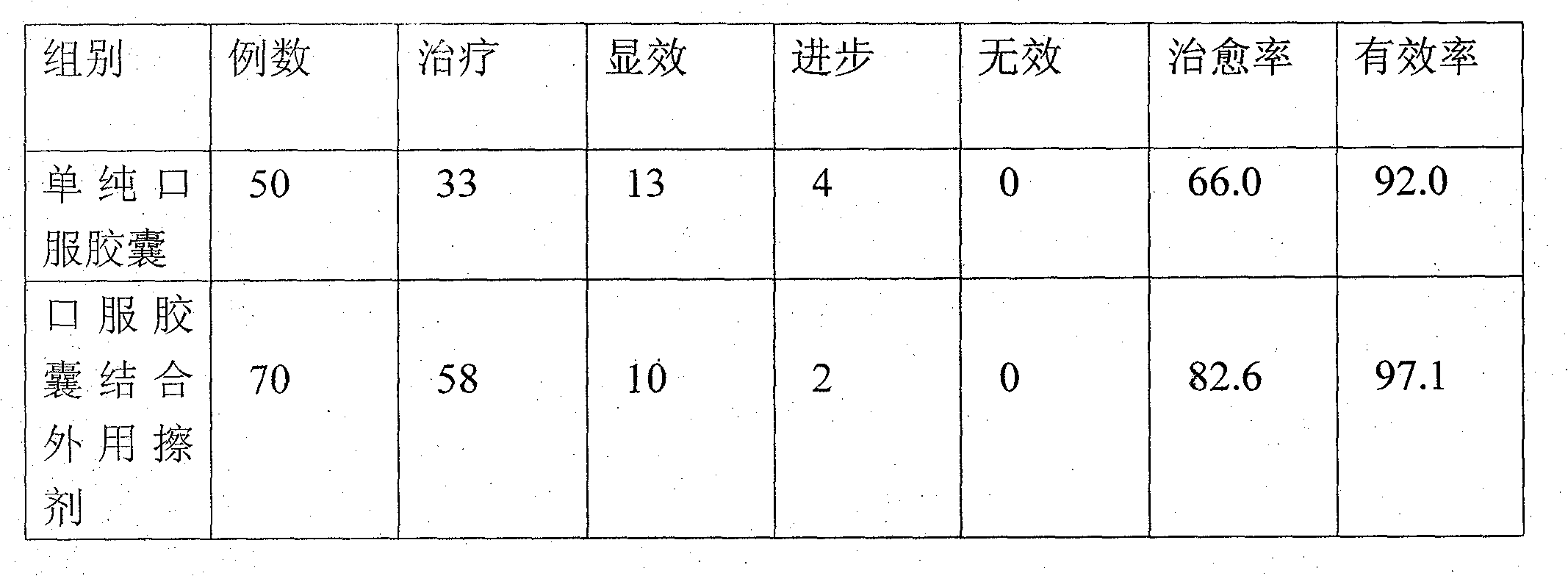 Chinese medicament for treating psoriasis vulgaris and preparation method thereof