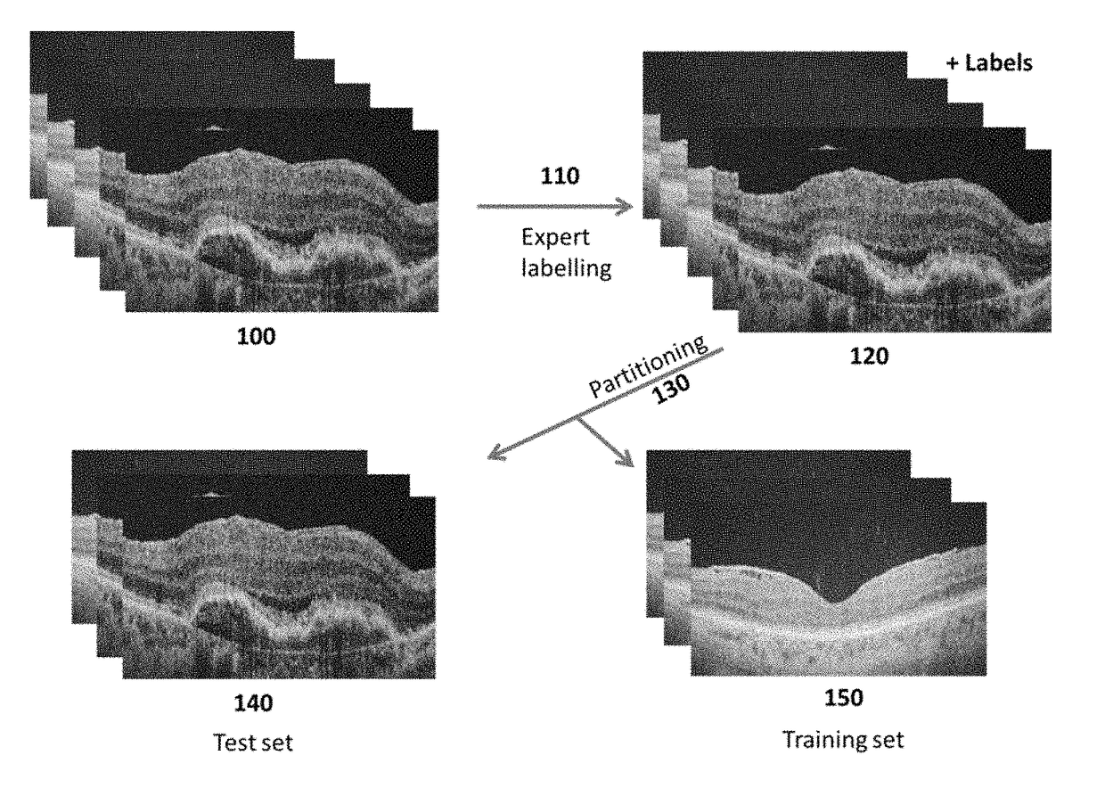 Systems and methods using weighted-ensemble supervised-learning for automatic detection of ophthalmic disease from images