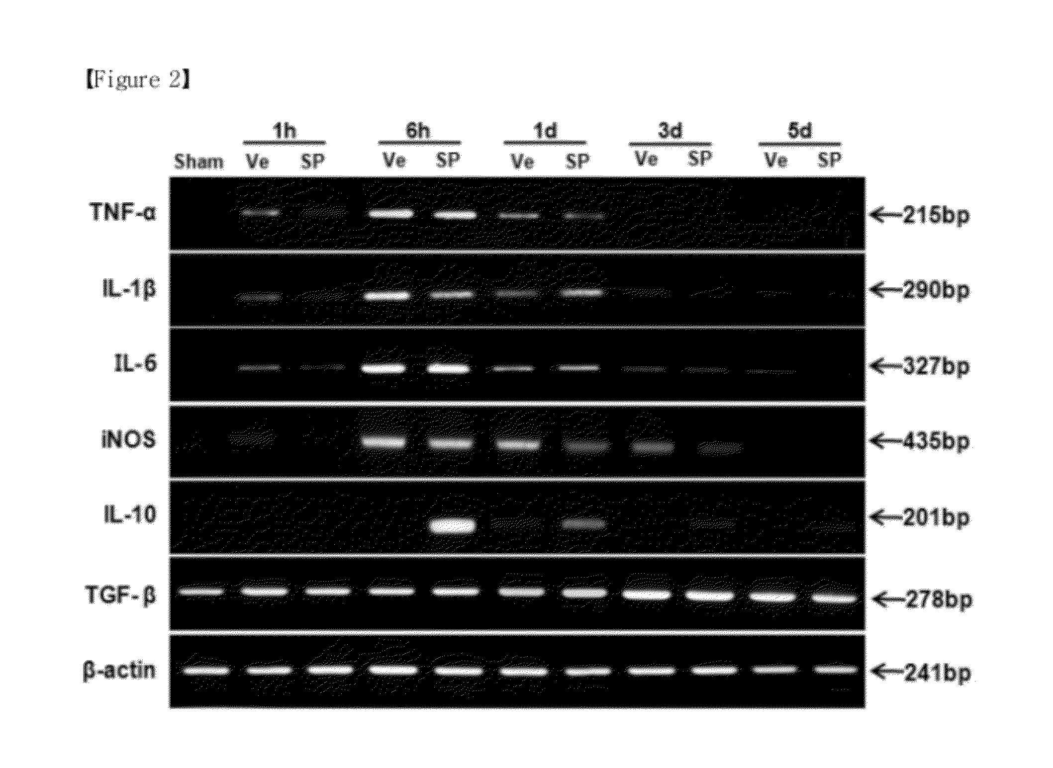 Composition for preventing or treating a spinal cord injury