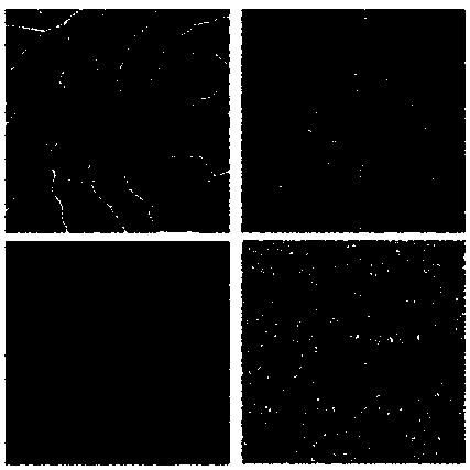 Analysis algorithm of macular region choroid membrane blood capillary density