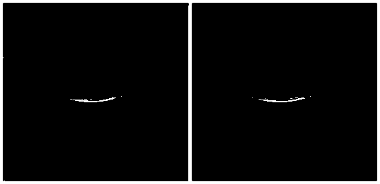 Analysis algorithm of macular region choroid membrane blood capillary density