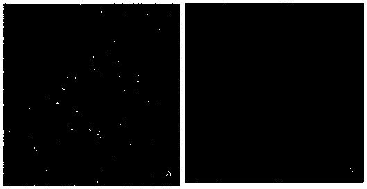 Analysis algorithm of macular region choroid membrane blood capillary density