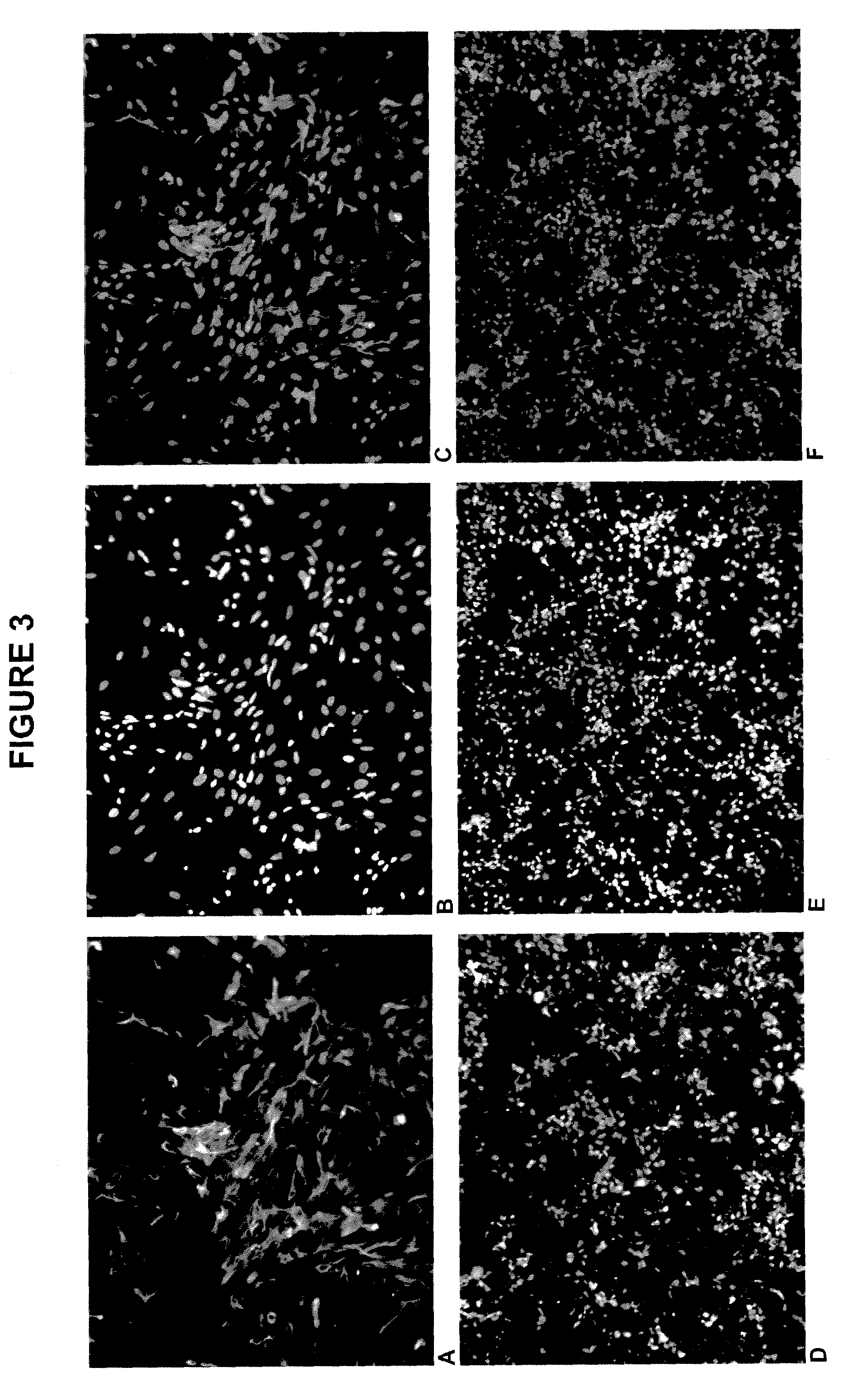 Neuronal progenitor cells and methods of derivation and purification of neuronal progenitor cells from embryonic stem cells