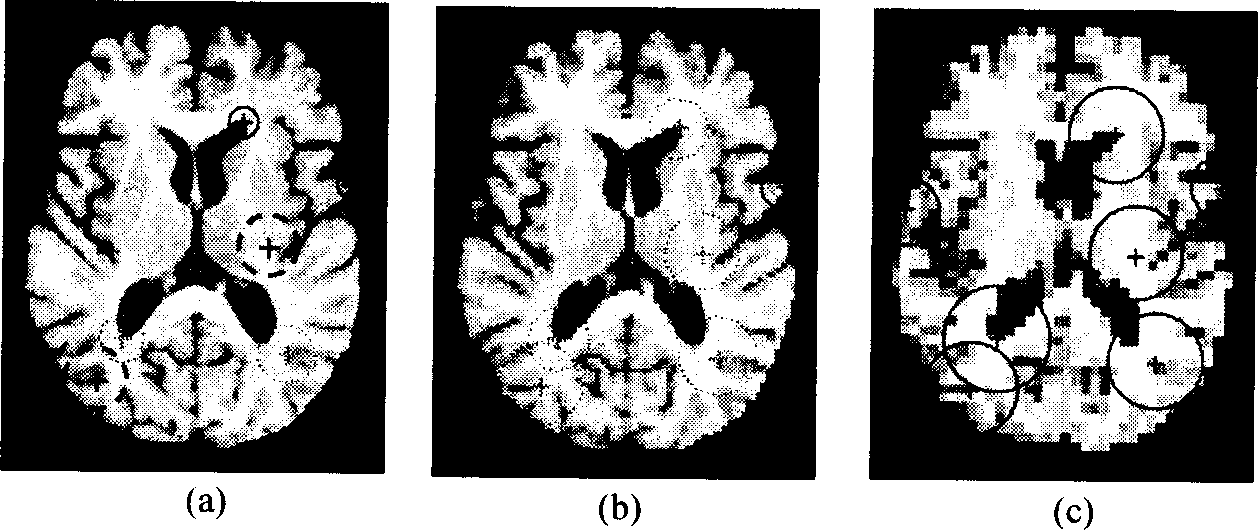 Elastic registration method of stereo MRI brain image based on machine learning