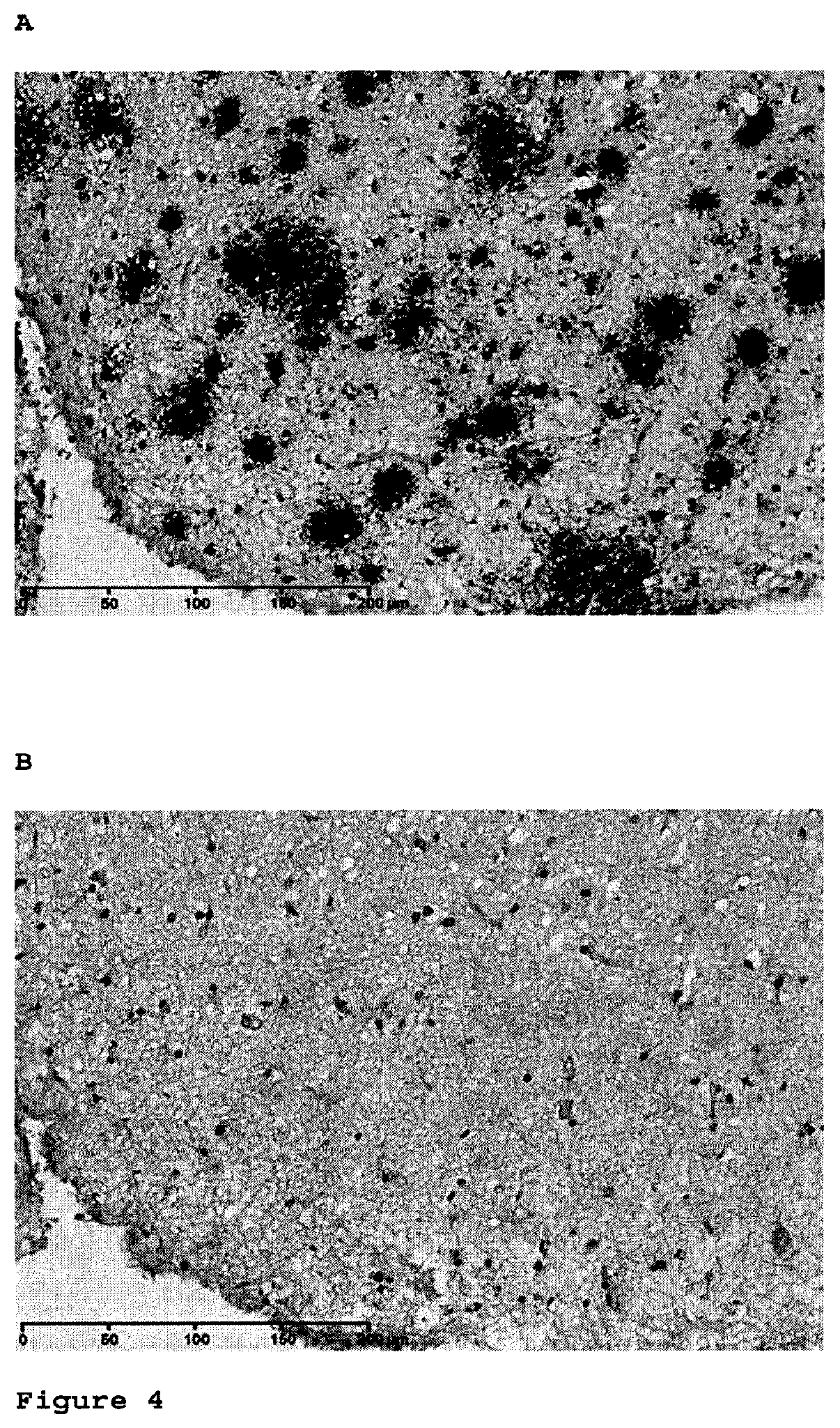 Antibodies to amyloid beta