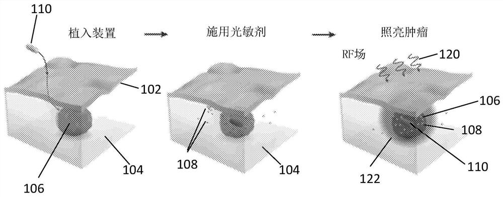 Photodynamic therapy devices, systems and methods