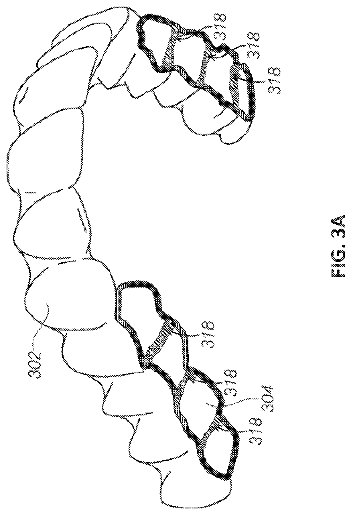 Dental appliance features for speech enhancement