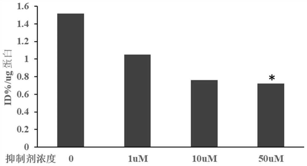 Application of D1 receptor-based targeting molecular probe in pancreatic beta cell imaging