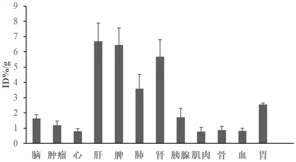 Application of D1 receptor-based targeting molecular probe in pancreatic beta cell imaging