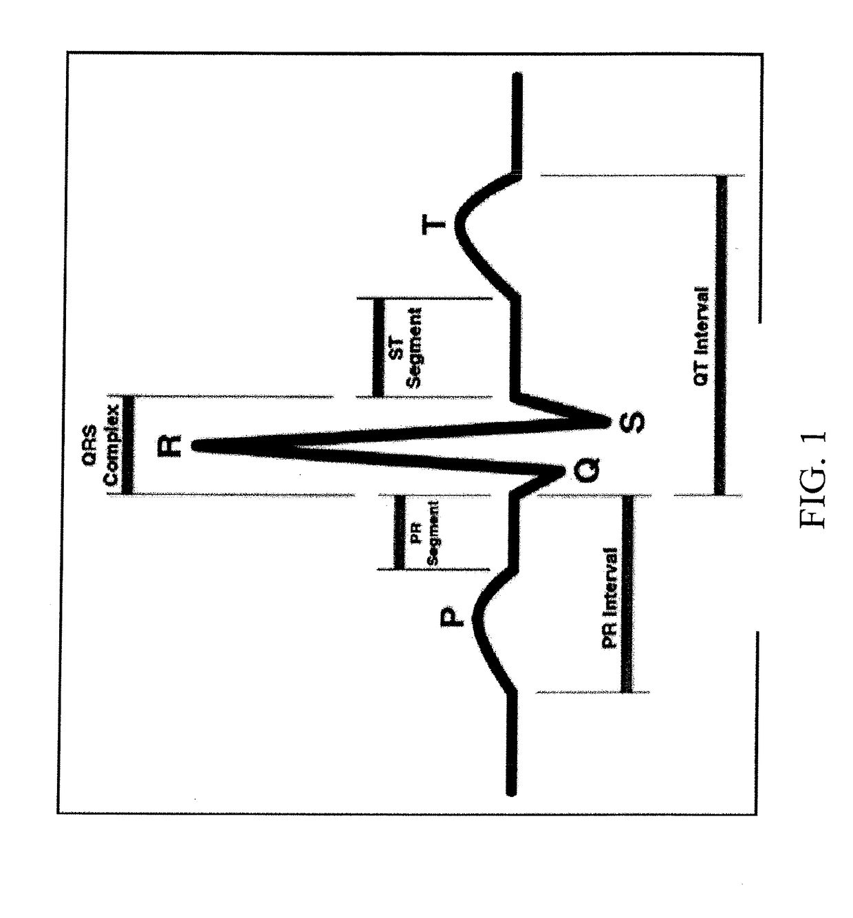 System and method for guidance of a catheter tip