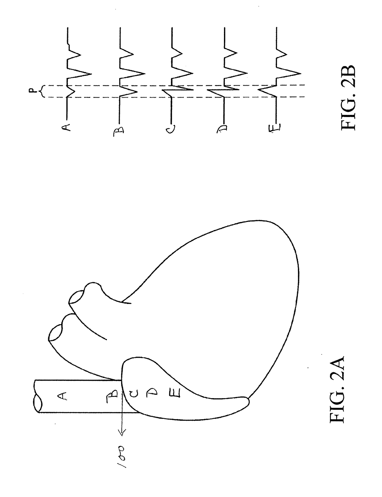 System and method for guidance of a catheter tip