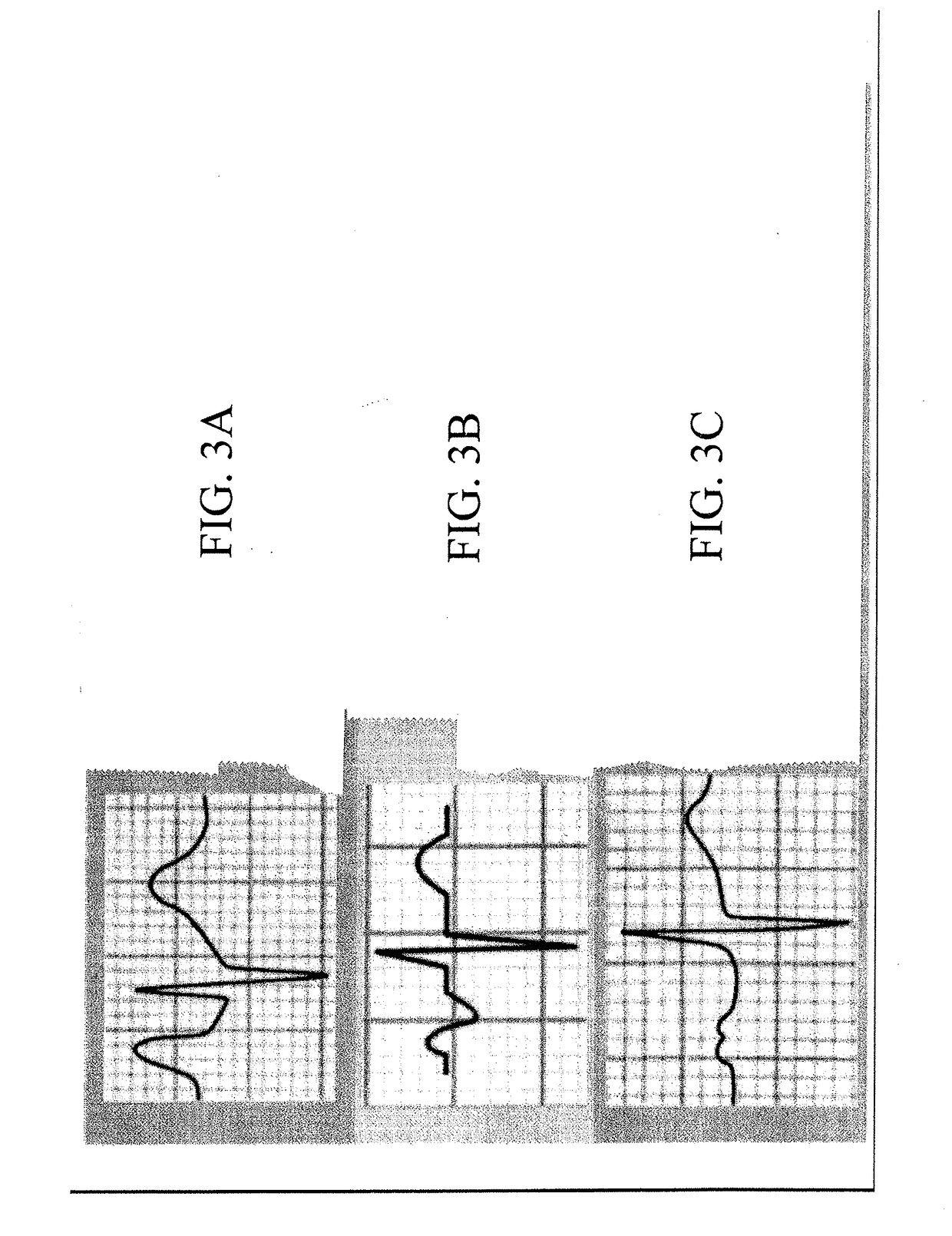 System and method for guidance of a catheter tip