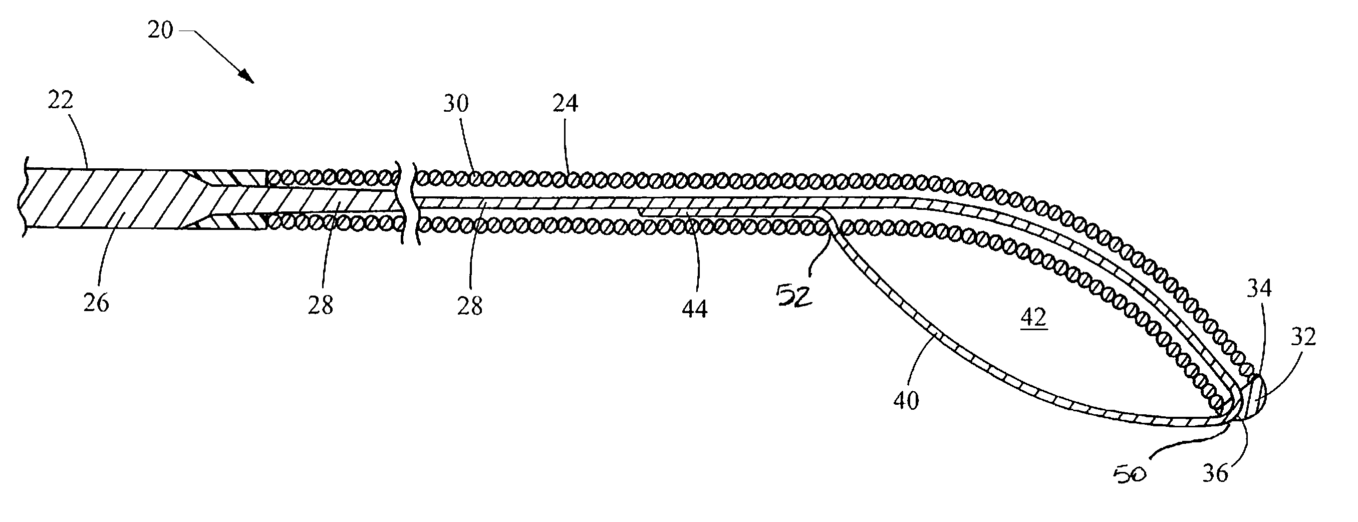 Coupling wire guide