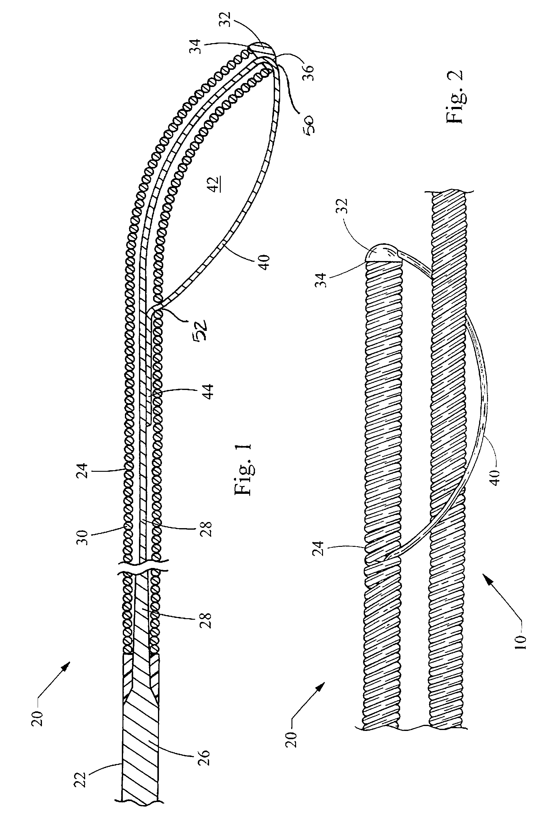 Coupling wire guide