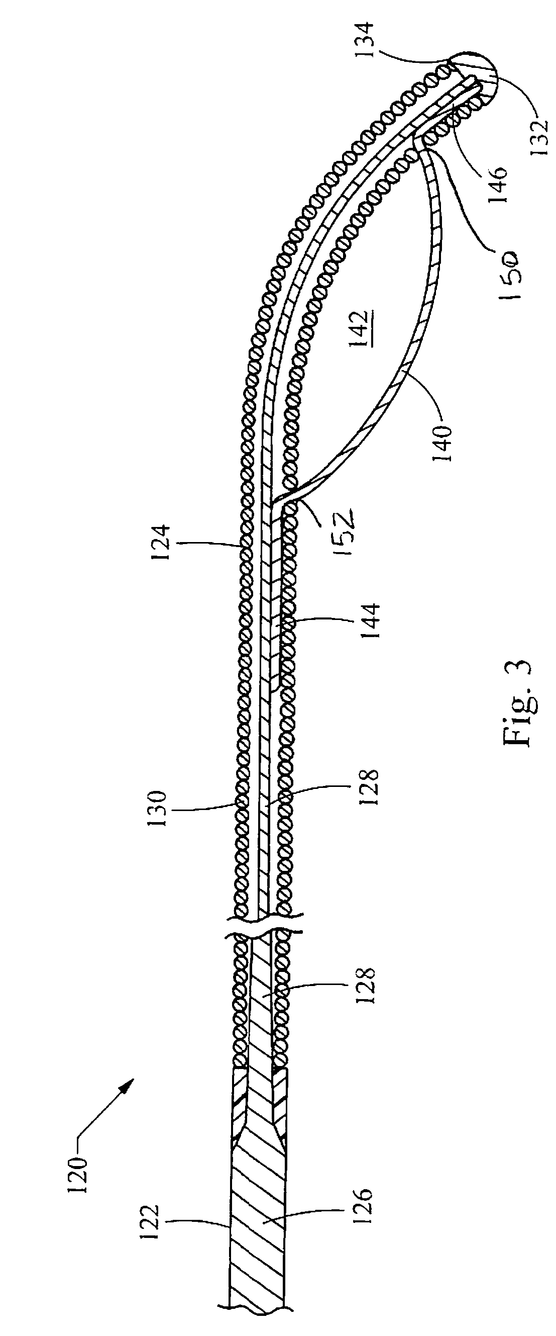 Coupling wire guide