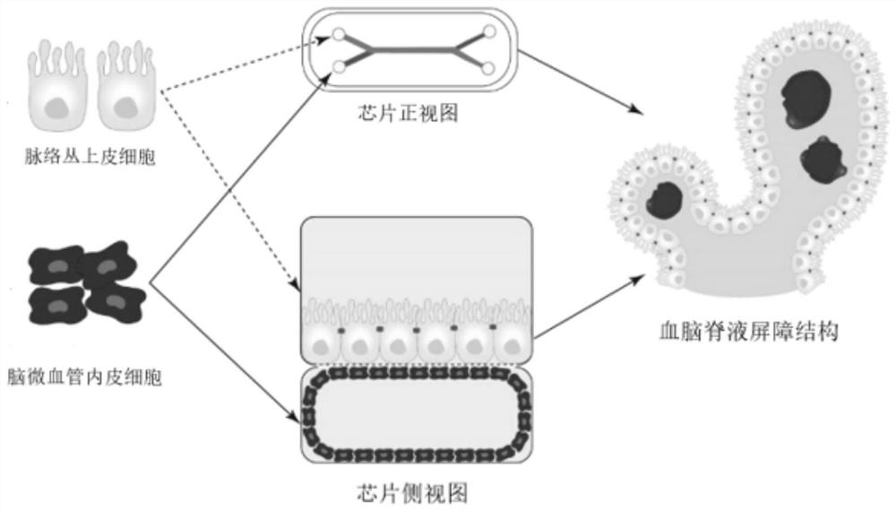 Human blood cerebrospinal fluid barrier model as well as preparation method and application thereof