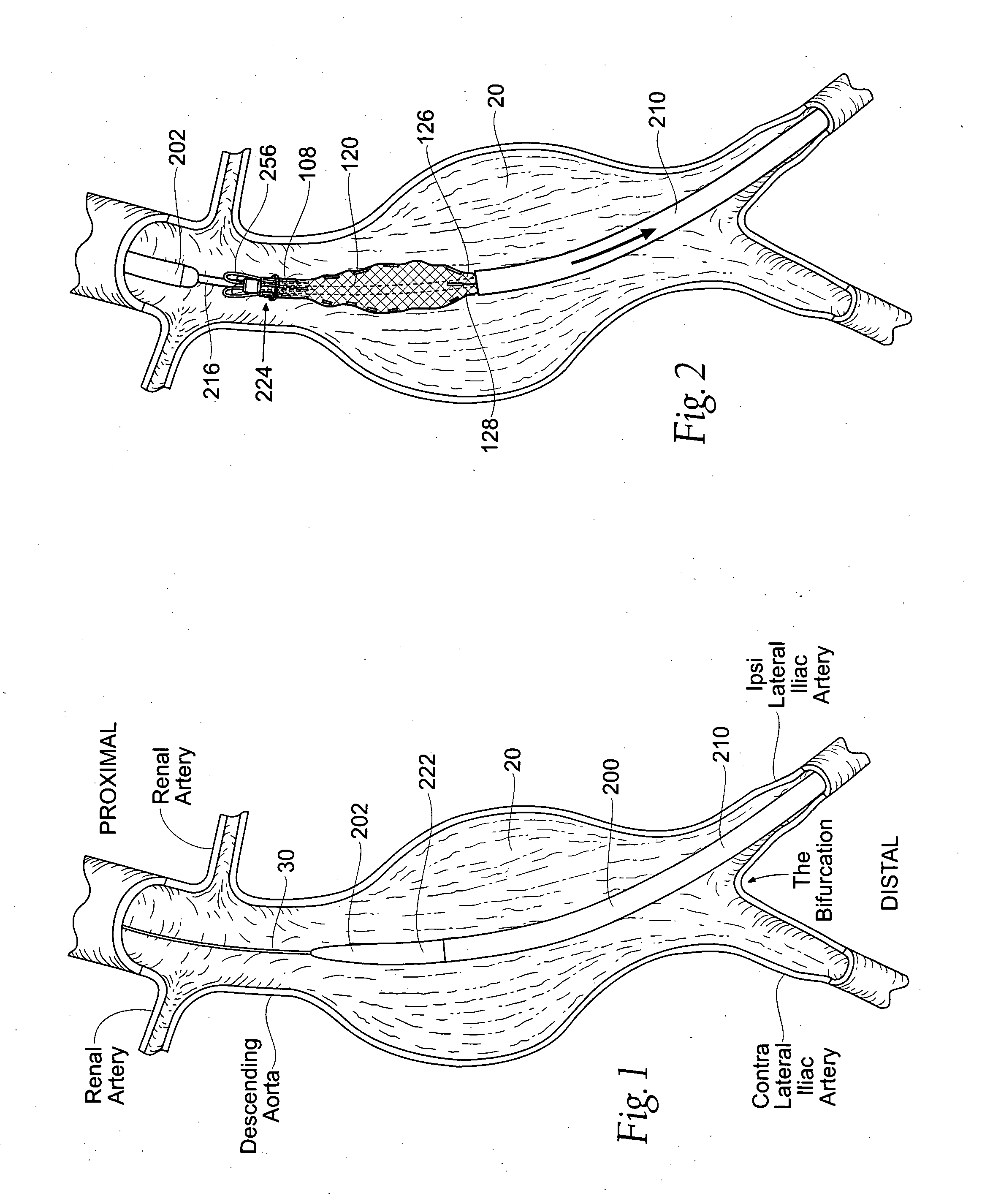 Devices, systems, and methods for prosthesis delivery and implantation, including the use of a fastener tool