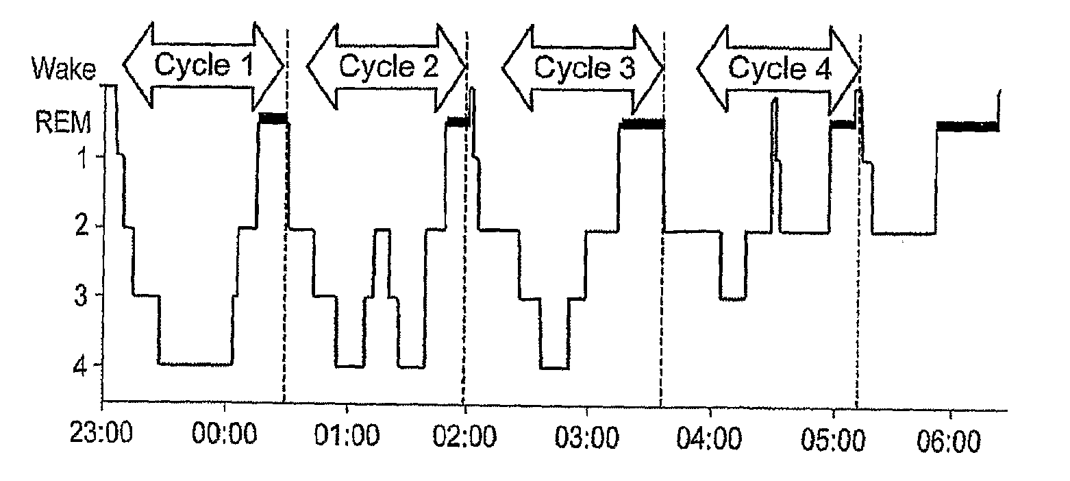 Method and apparatus for assessing sleep quality