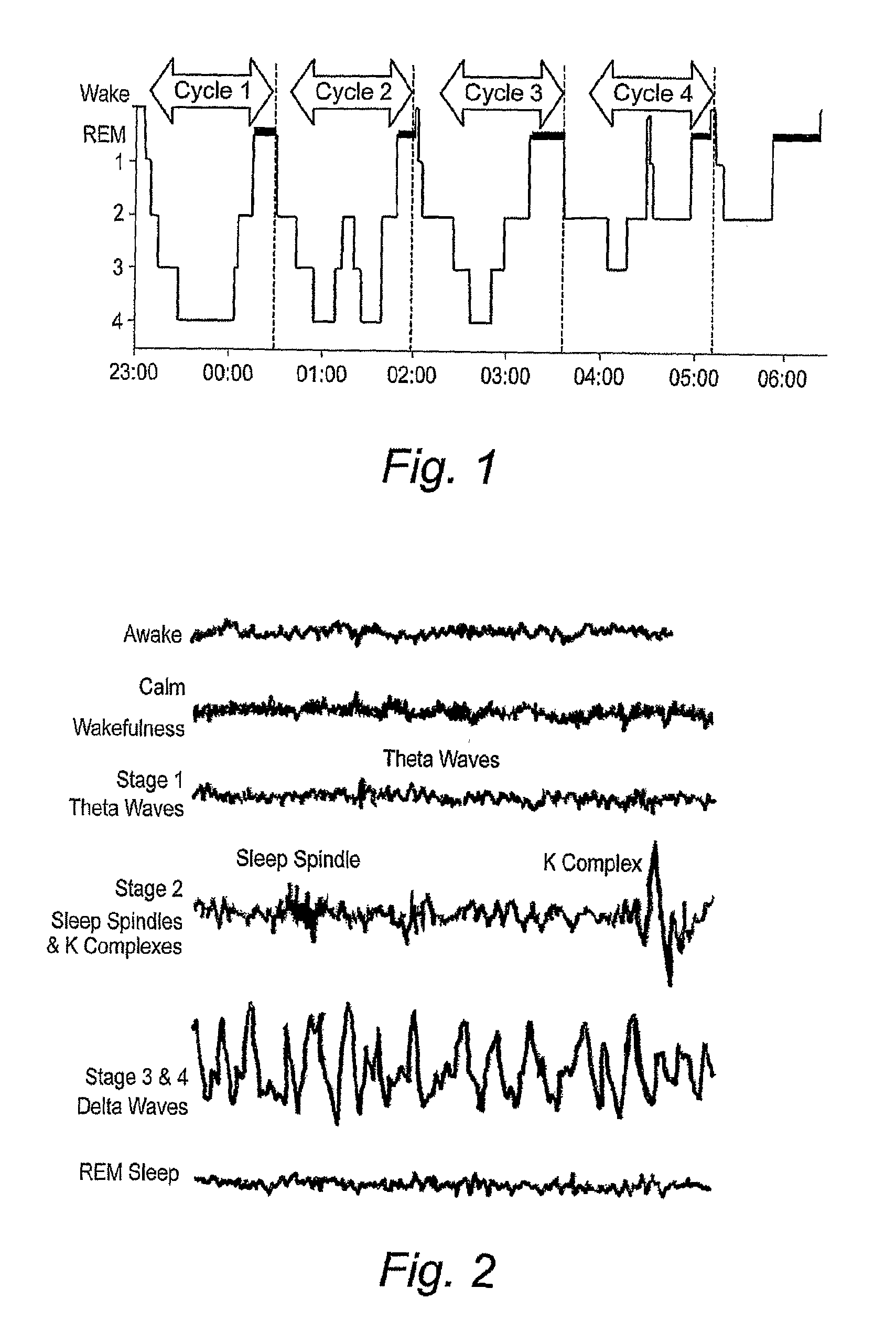 Method and apparatus for assessing sleep quality