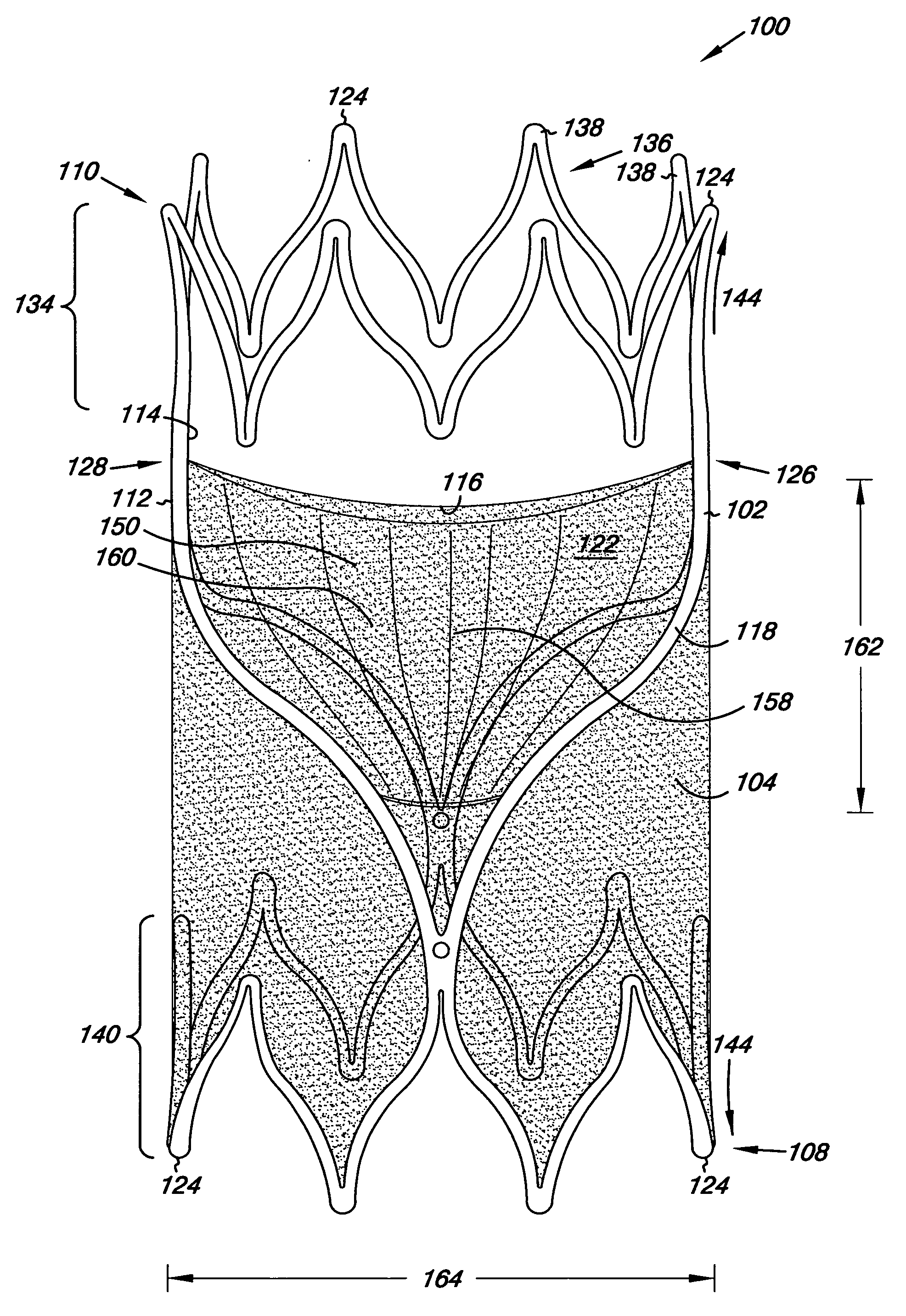 Venous valve, system, and method