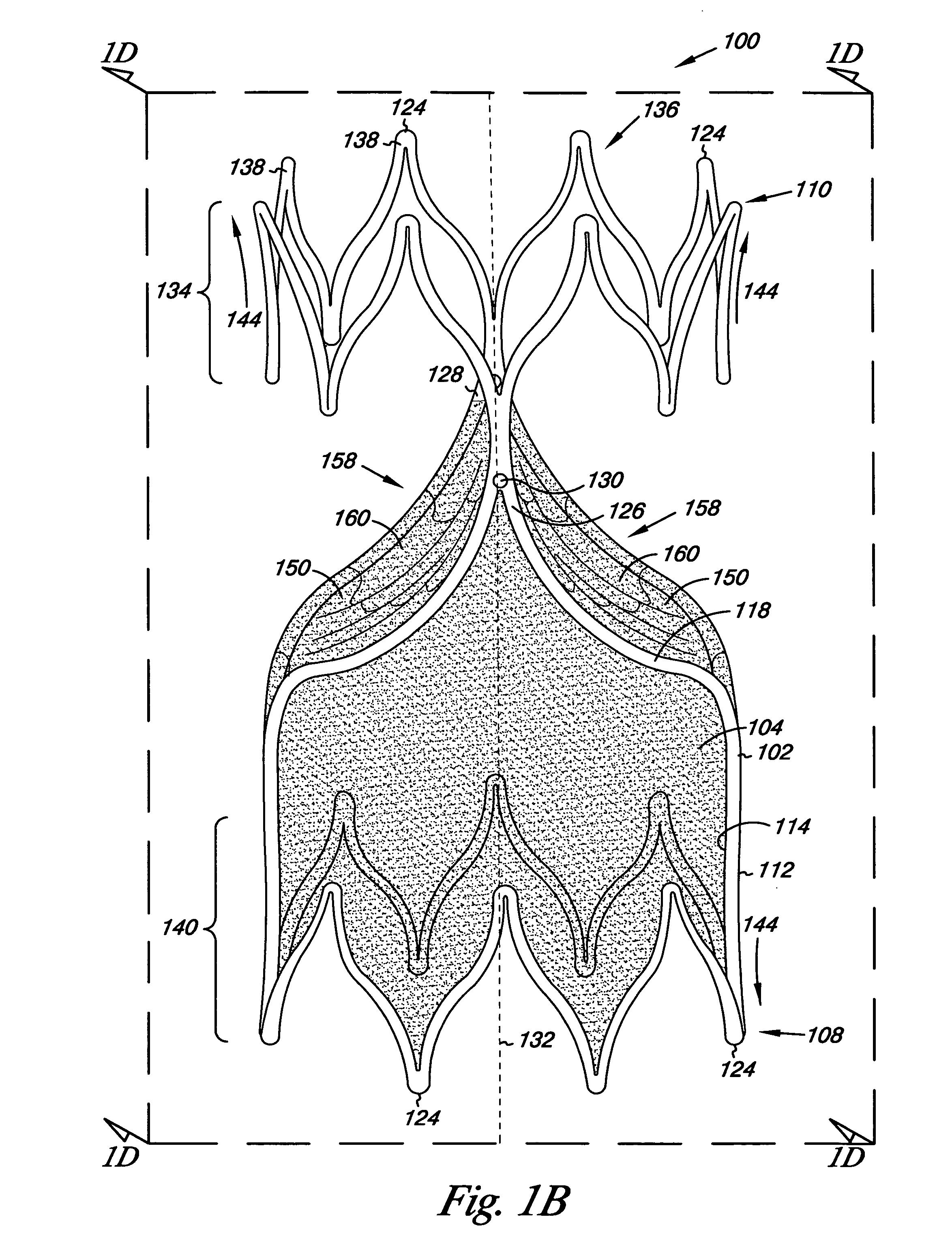 Venous valve, system, and method