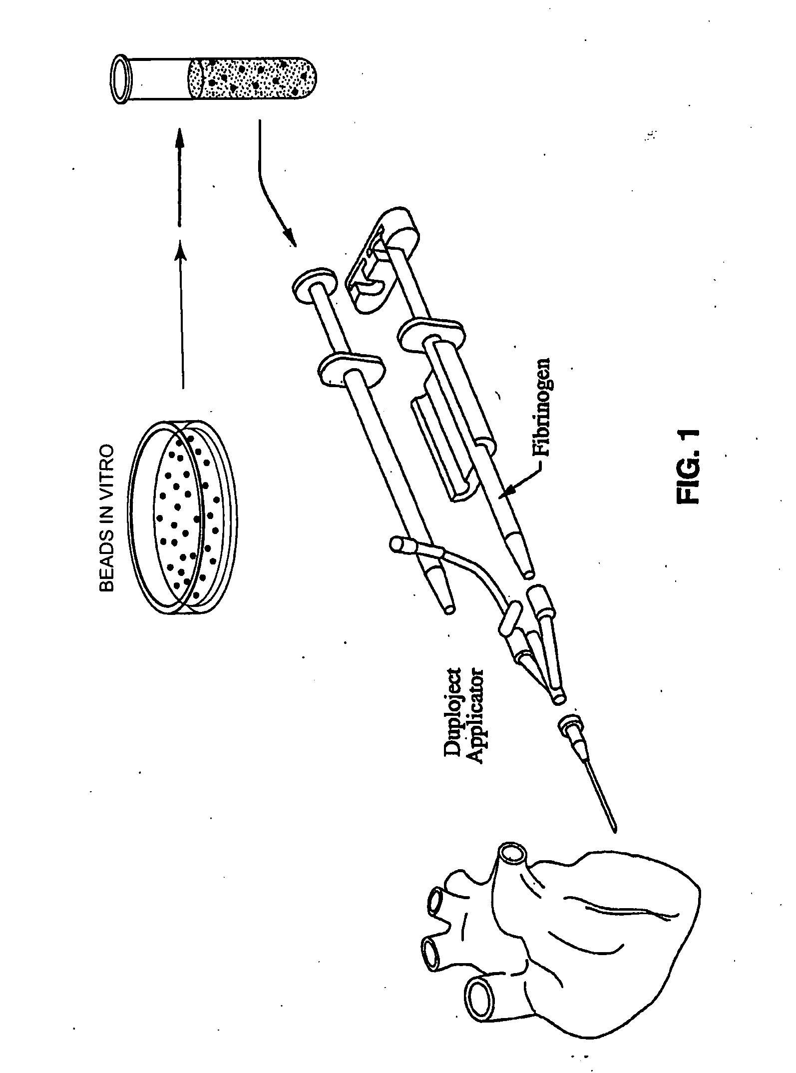 Methods and apparatus for using polymer-based beads and hydrogels for cardiac applications
