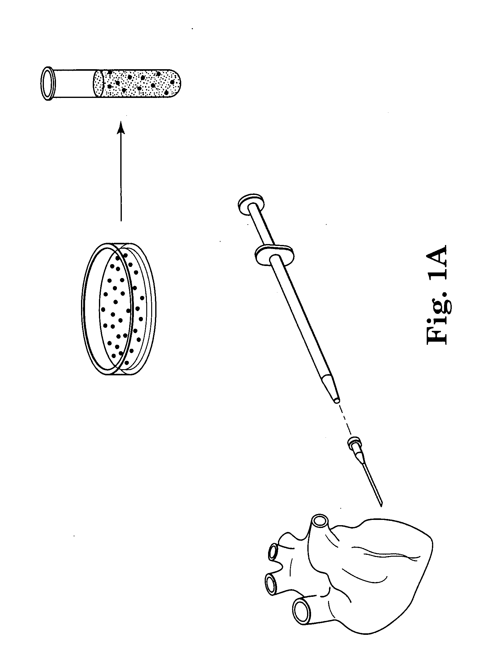 Methods and apparatus for using polymer-based beads and hydrogels for cardiac applications