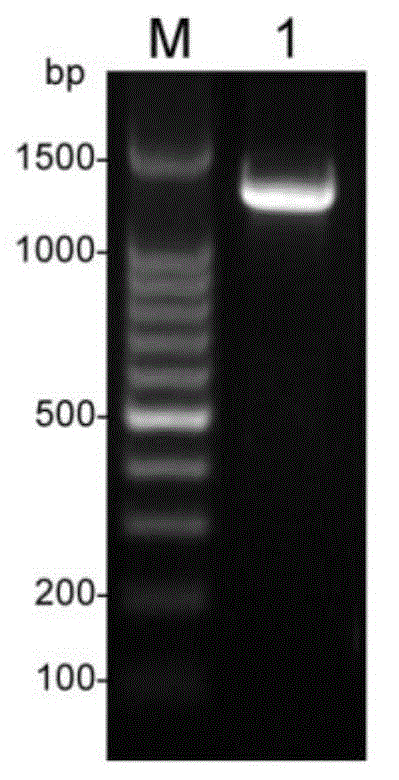 Recombinant antigen protein for diagnosing echinococcosis granulosa as well as preparation method and application thereof