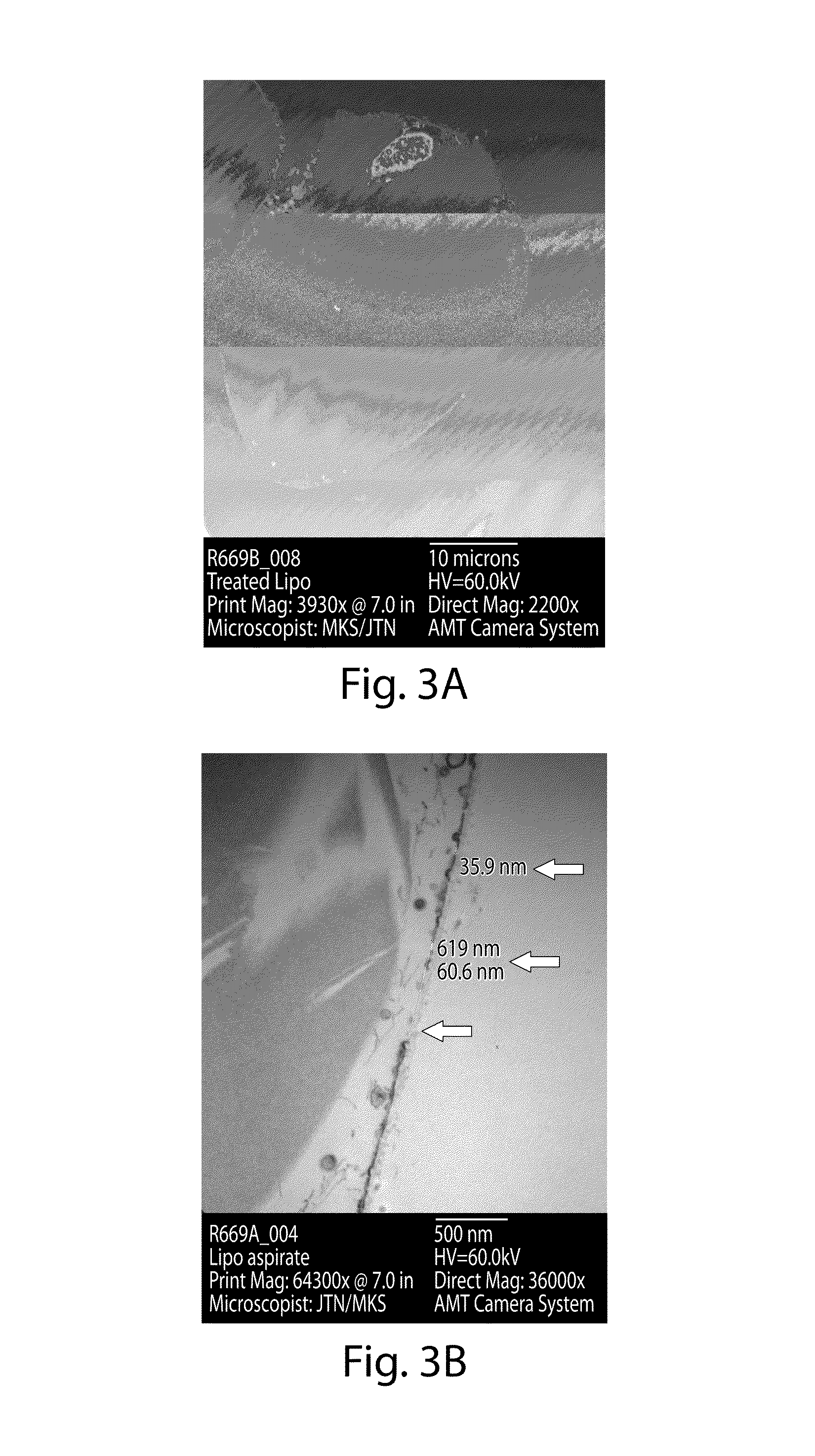 Method of preventing fat graft resorption by administering fat-derived cells and poloxamer P 188