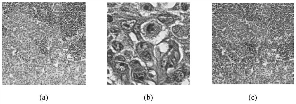 Method of color normalization of pathological images based on low-rank embedded non-negative matrix factorization