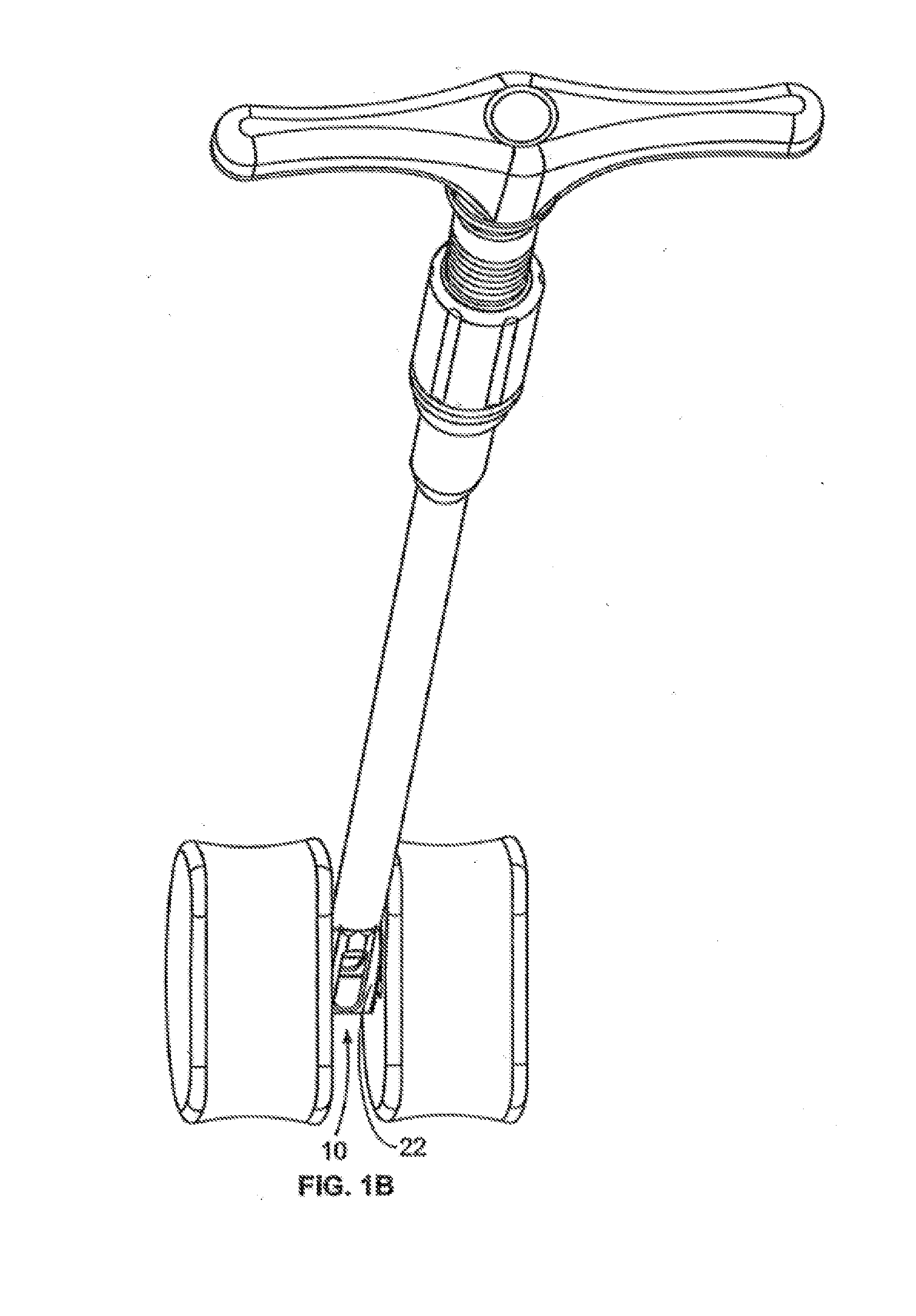Methods and Systems for Interbody Implant and Bone Graft Delivery