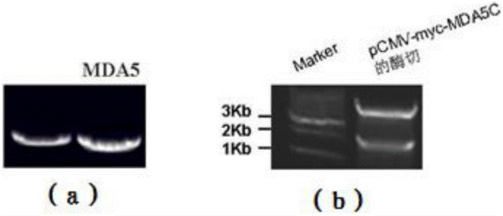 Non-radioactive label immunoprecipitation method for detecting specific self-antibody MDA5 of inflammatory myopathy