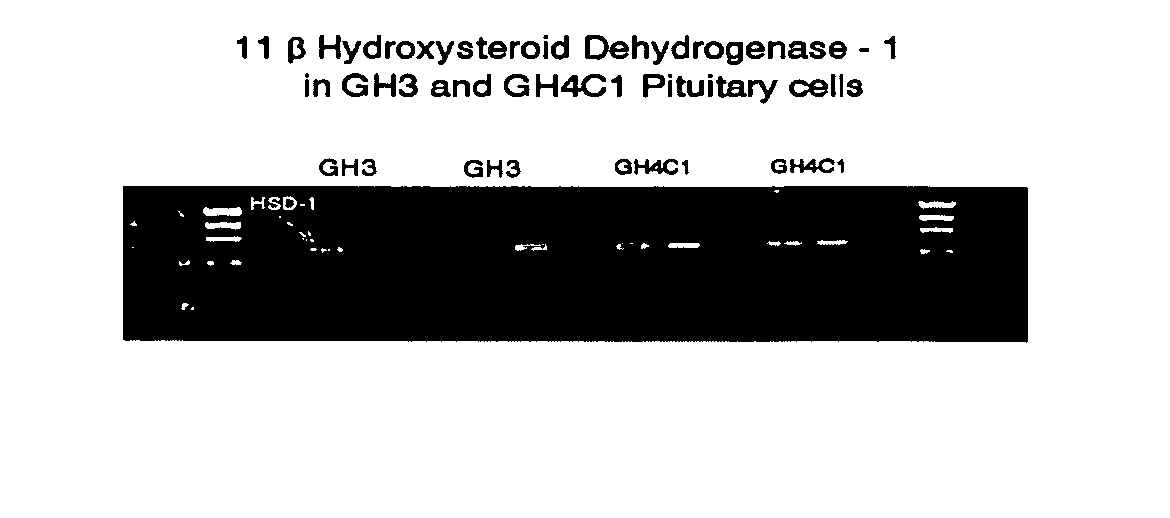 RNA interference mediated inhibition of 11beta hydroxysteriod dehydrogenase-1 (11beta HSD-1) gene expression