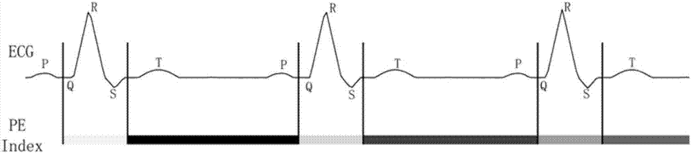 A magnetic resonance data acquisition method and magnetic resonance imaging system